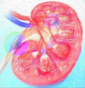腎移植の成功を決める新たな抗原LIMS1を発見
