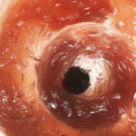 遺伝子改変免疫細胞移植で新たな感染症を予防する