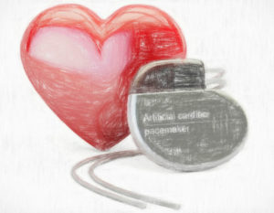 電池交換不要の心臓ペースメーカー【無限の電池寿命を目指して】