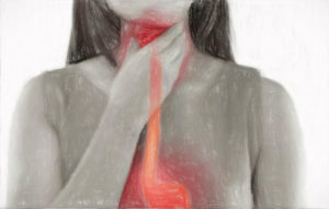 胃食道逆流症の治療や予防 【胸焼け症状が続くとがんができることも】