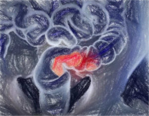 大腸がんの治療法 【手術前後の注意点も】