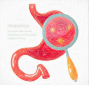 家庭でできる急性胃腸炎の対処 【食事・飲み物・うつらないようにする方法】