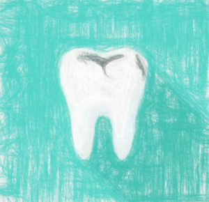 虫歯アラカルト 【原因菌、進行度、治療費、予防法】