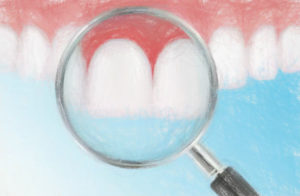 歯周病を予防する歯みがき法 【医師おすすめ歯磨き粉3選も】