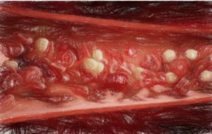 血液成分とその役割【血液の基本】