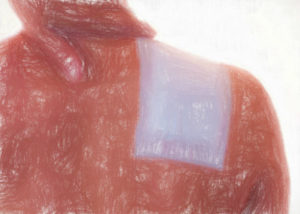 湿布タイプの鎮痛薬 【市販薬のおすすめ】