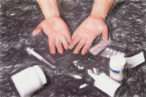 じんましんの薬と病院の治療 【家庭でできる対応法も】