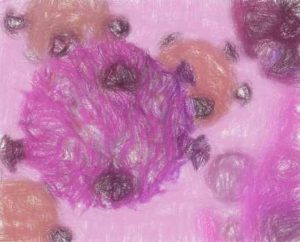 CAR-T療法の研究開発を俯瞰する 【現状と課題】