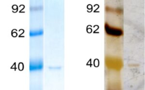 タンパク質の染色の基本 【CBB/銀染色/蛍光染色】